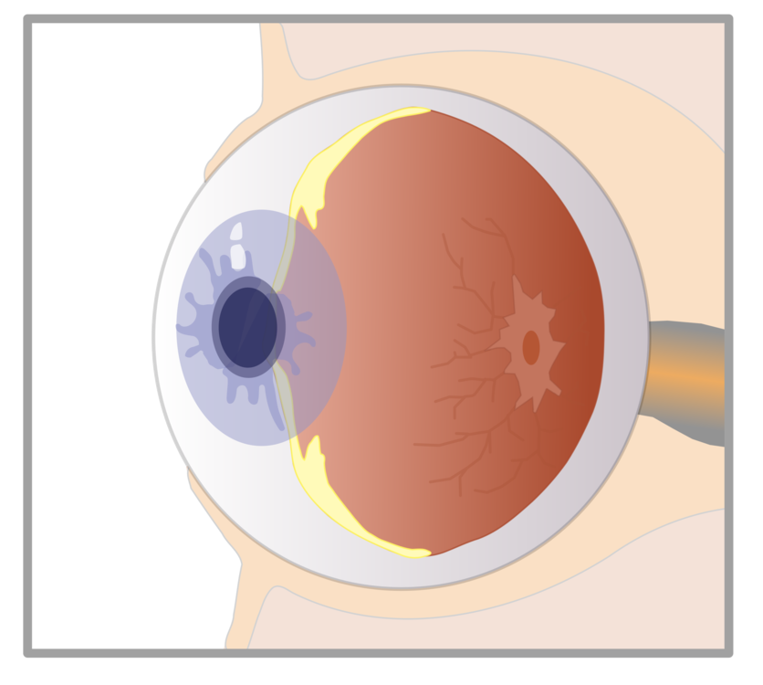 Iris,Human Body,Eye