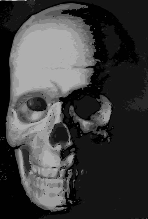 Head,Radiology,Skull
