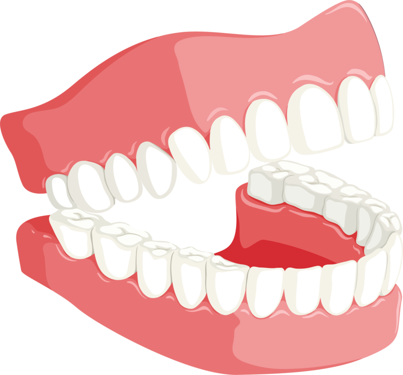 Dentures,Organ,Jaw