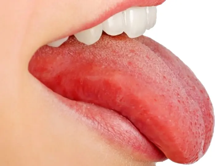 Close-up of a Red Tongue and White Teeth
