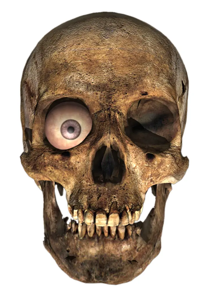 Skull with One Eye
