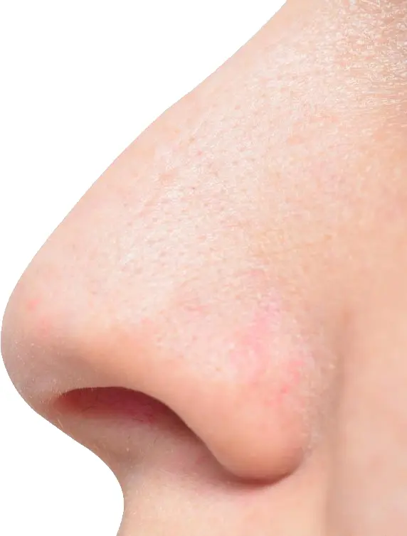 Close-up of a Human Nose