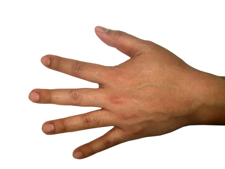 Hand with Fingers Spread